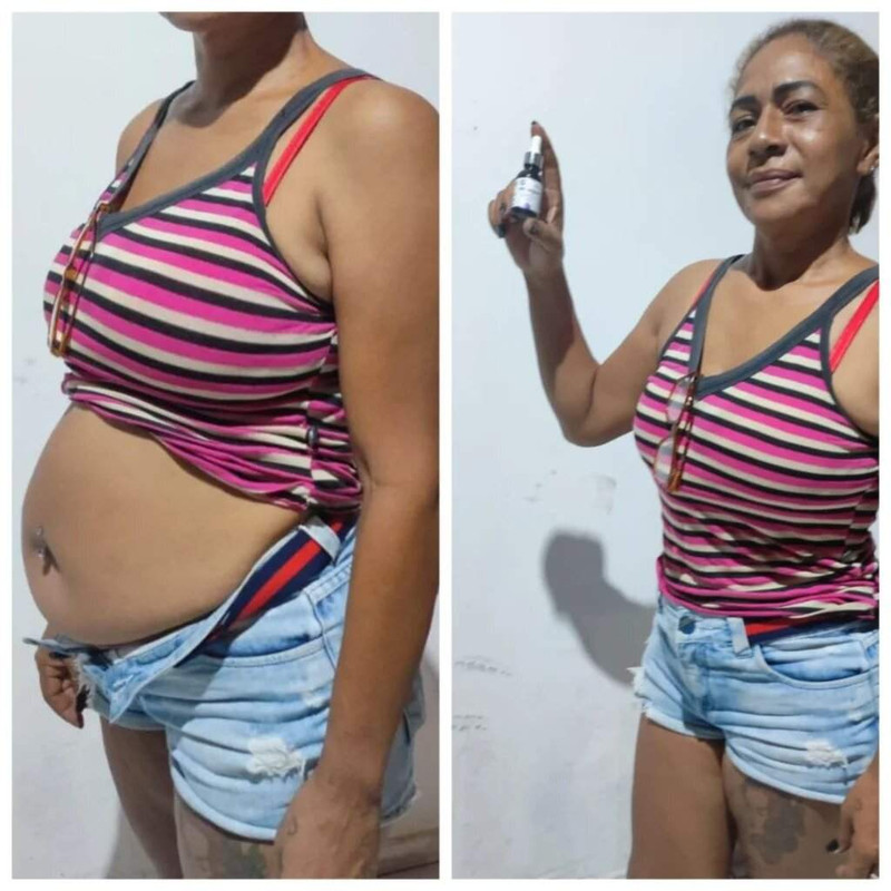Antes e depois real de quem usou Mounjax